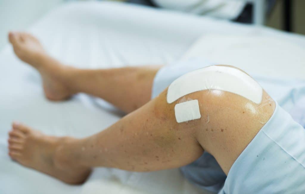 5 Common Questions About Total Knee Replacement
